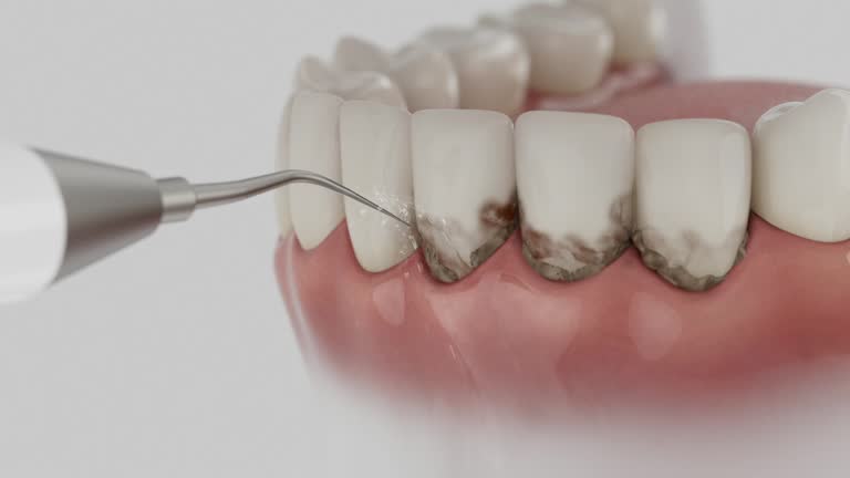 Reliable Dental Implants contractor in Intercourse, PA by Smile Center Dentistry